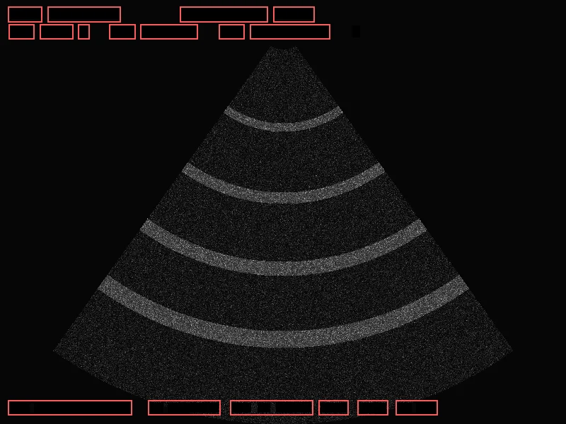 After — as stored by the research archive (redacted regions outlined): synthetic ultrasound frame with a burned-in patient header
