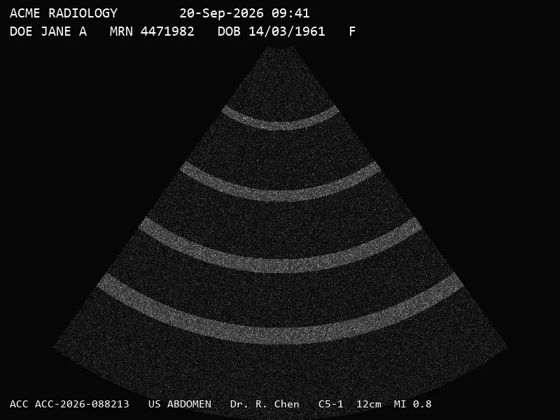 Before — as sent by the modality: synthetic ultrasound frame with a burned-in patient header