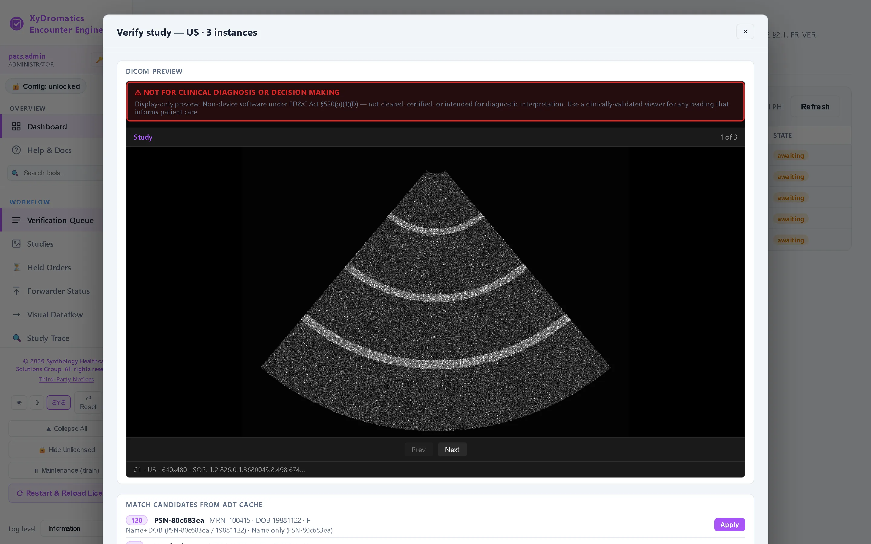Verify an encounter — Open a study: the DICOM preview (display-only, never for diagnosis), the ADT candidates the match engine scored, and the 3-column diff — what the probe sent, what the feed proposes, what the verifier commits with Accept & Send.